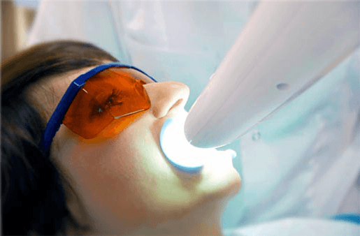 Understanding the Causes of Teeth Sensitivity Swindon