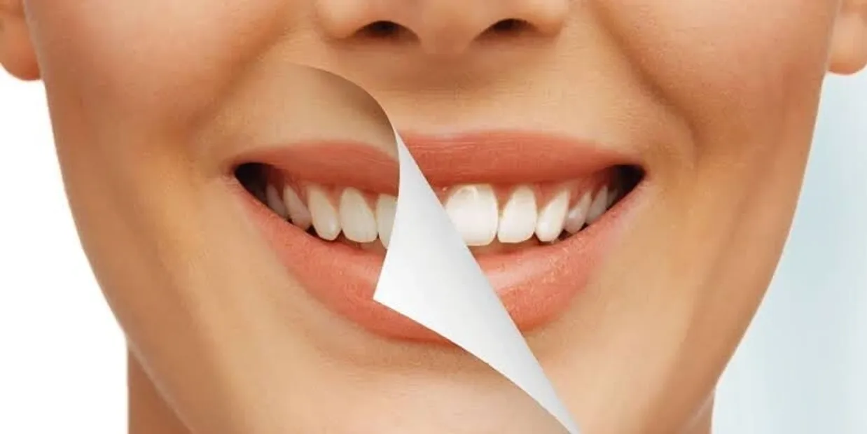 Can Laser Teeth Whitening Damage Your Dental Crowns Swindon?