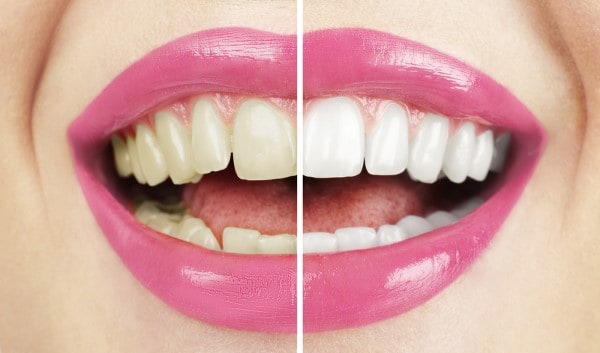 What Early Signs of Oral Cancer Should You Never Ignore Swindon?