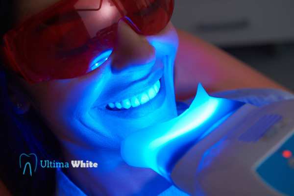 Professional Teeth Whitening Options Swindon