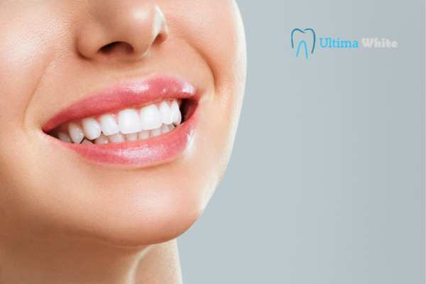 Common Mistakes That Can Ruin Your Whitening Results Swindon