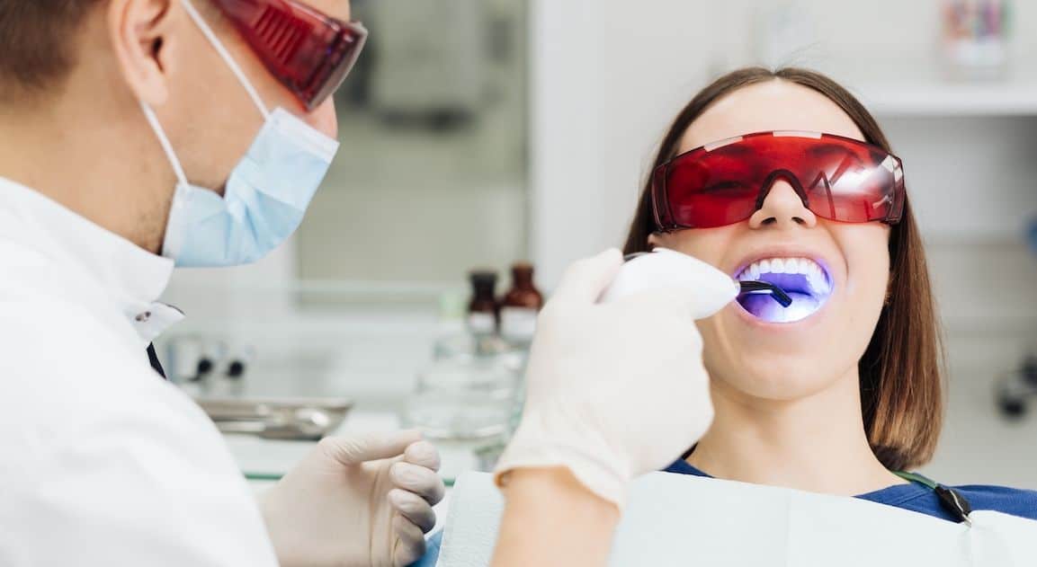 Do Dental Crowns Change Colour After Teeth Whitening Swindon?