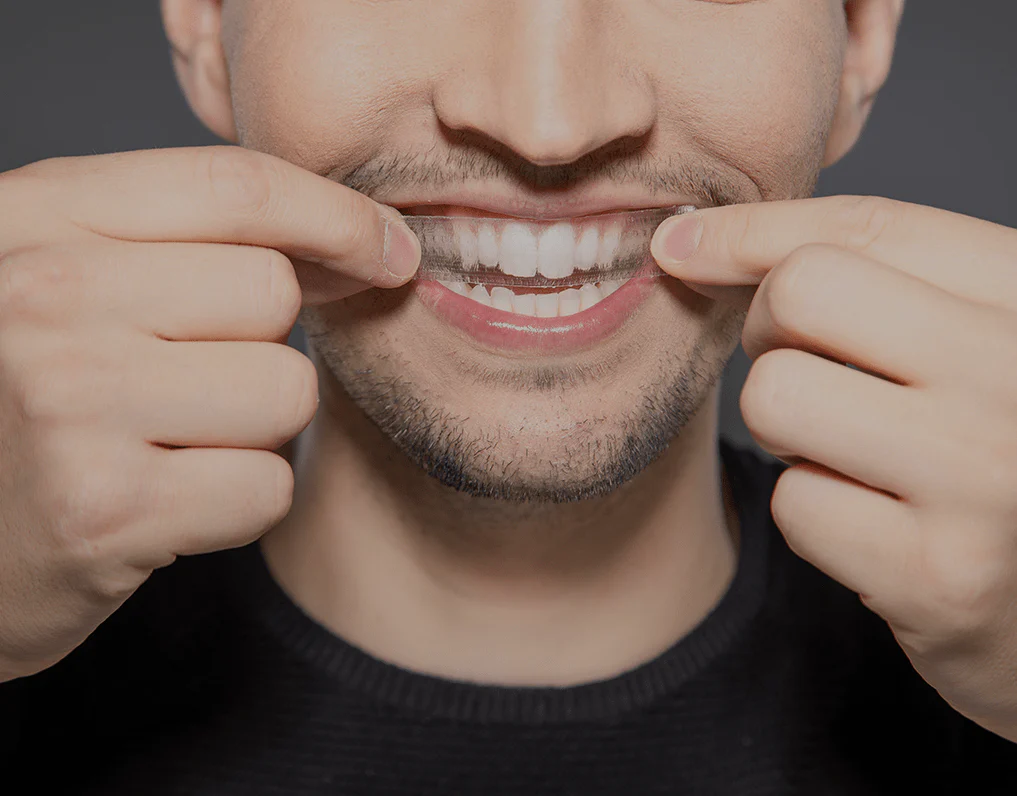 How Are Invisible Aligners Changing Orthodontic Treatments Swindon?