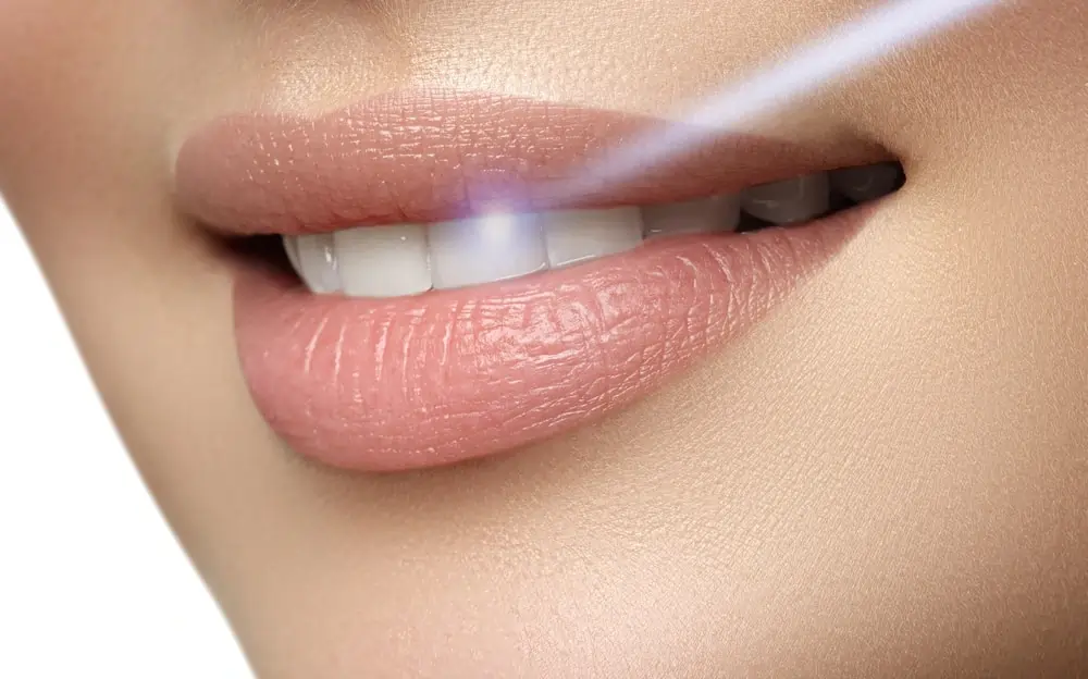 Understanding Teeth Whitening Risks and Results Swindon