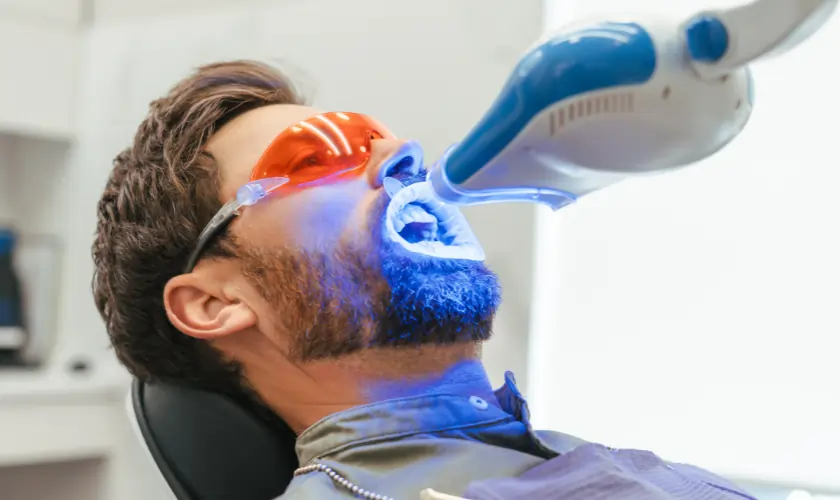 What Is Laser Teeth Whitening and How Does It Work Swindon?