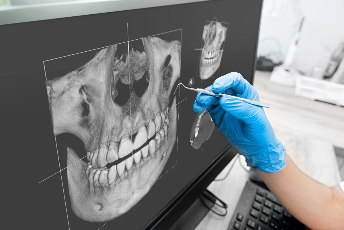 How Is AI Transforming Dental Treatment Planning Swindon?