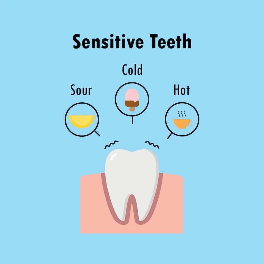 Why Do Teeth Become Sensitive After Whitening Treatments Swindon?