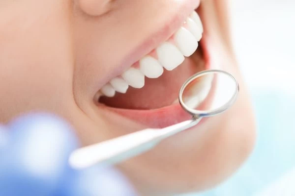 Preventing Complications: Tips for Maintaining Oral Health Swindon