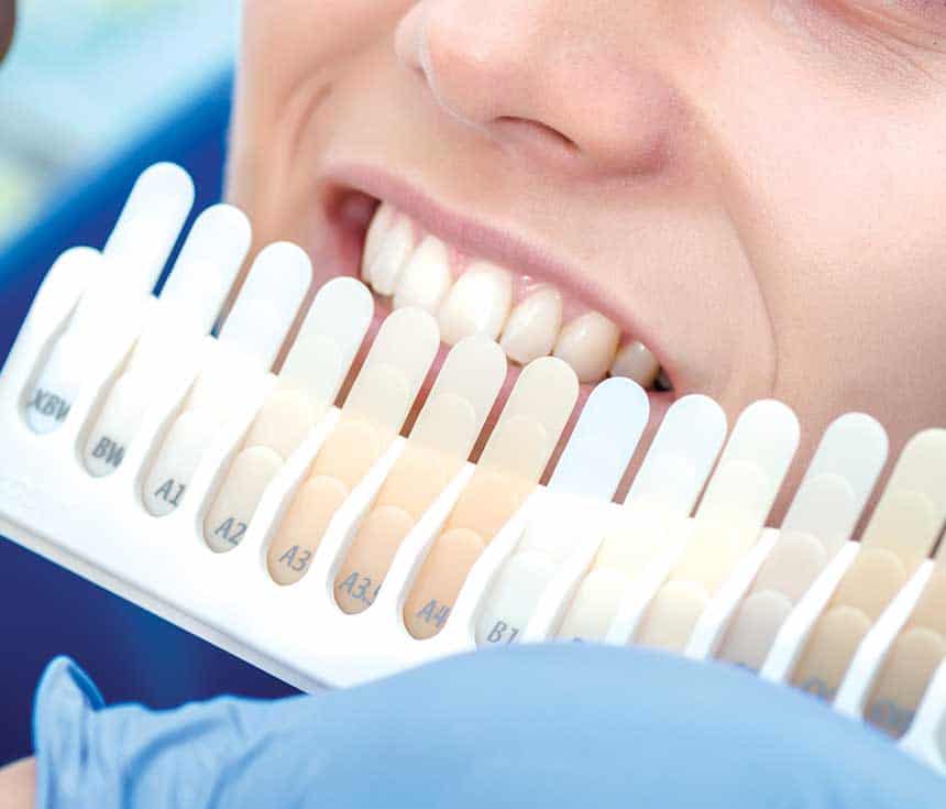 Is Laser Teeth Whitening Worth It for a Brighter, Confident Smile Swindon?