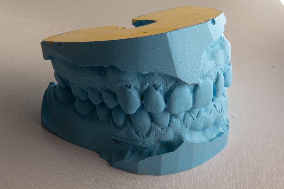 How Do Dental Implants Improve Jawbone Health and Oral Function Swindon?