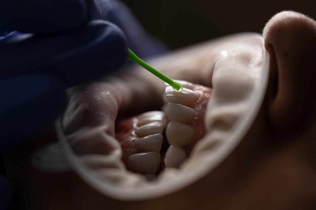 How Saliva Protects Your Teeth and Gums Swindon