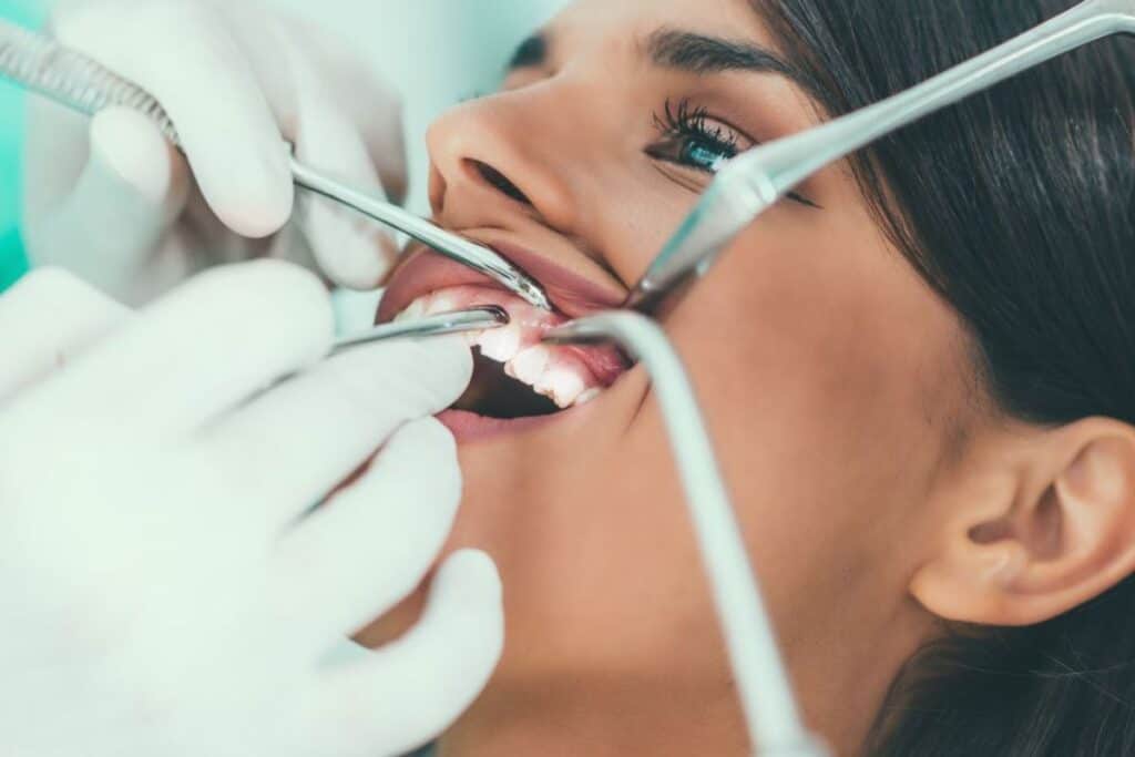 Braces Are Just for Kids – Myth or Reality Swindon