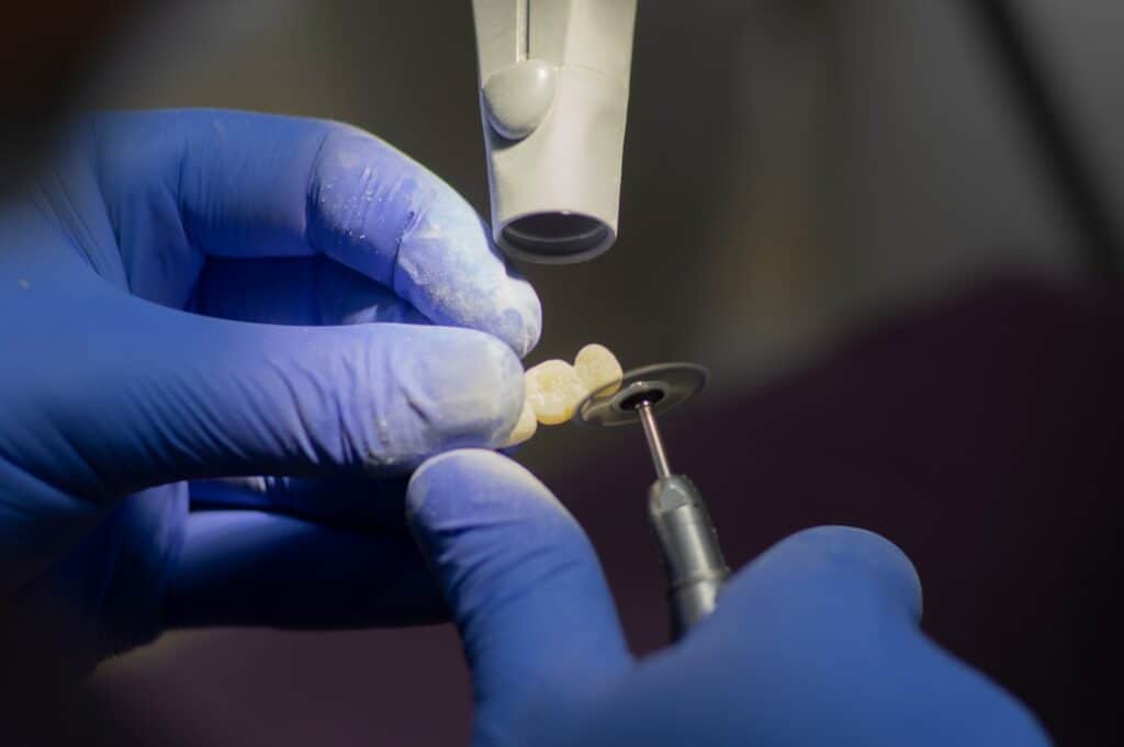 Customised Dental Solutions: Crowns, Aligners, and Implants Swindon