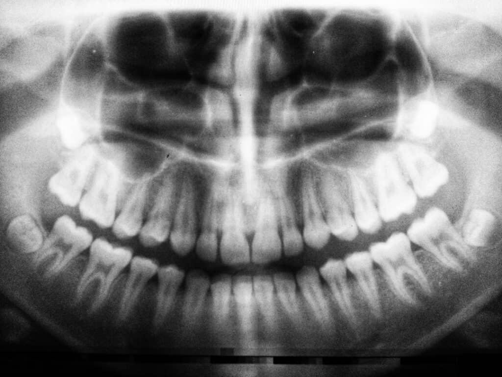 The Future of 3D Printing in Oral Healthcare Swindon